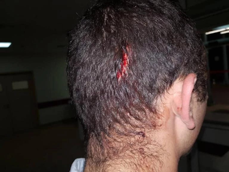 Επίθεση Ρομά σε αστυνομικούς: Μαχαιροβγάλτης που αποφυλακίστηκε με τον νόμο Παρασκευόπουλου ο ένας από τους δράστες